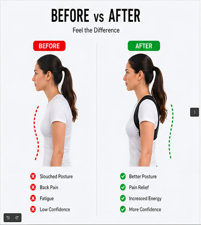 Posture Corrector